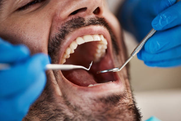 Best Broken or Cracked Tooth Emergency Dentist in Bladenboro, NC