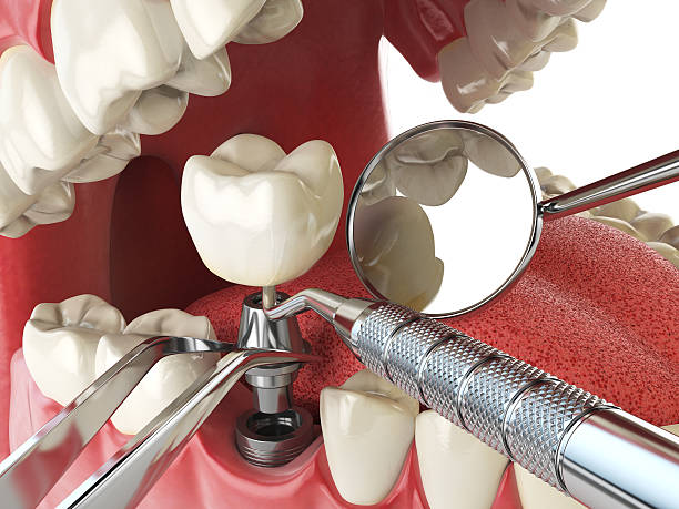 Best Emergency Dentist for Knocked-Out Tooth in Bladenboro, NC